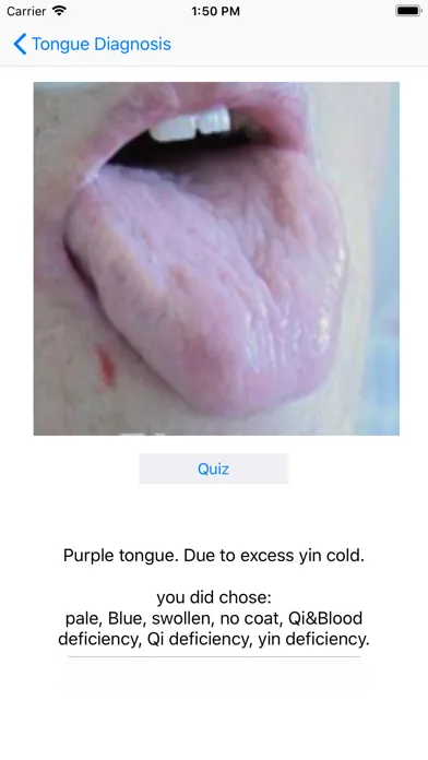 تصاویر Tongue Diagnosis