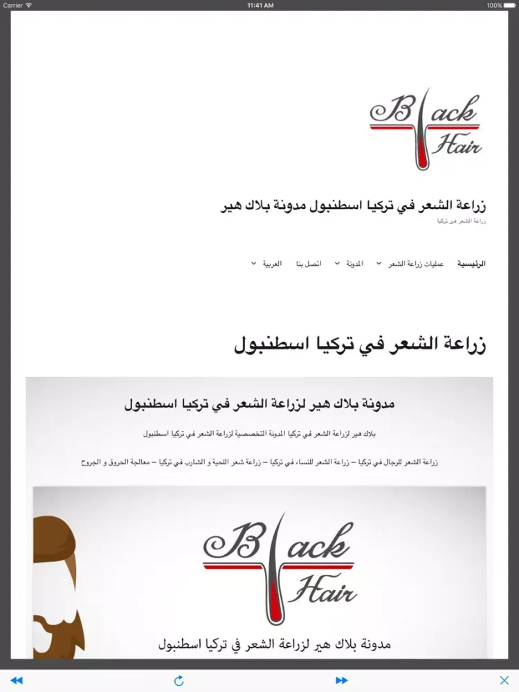 Captures d'écran de مدونة زراعة الشعر في تركيا iPad 