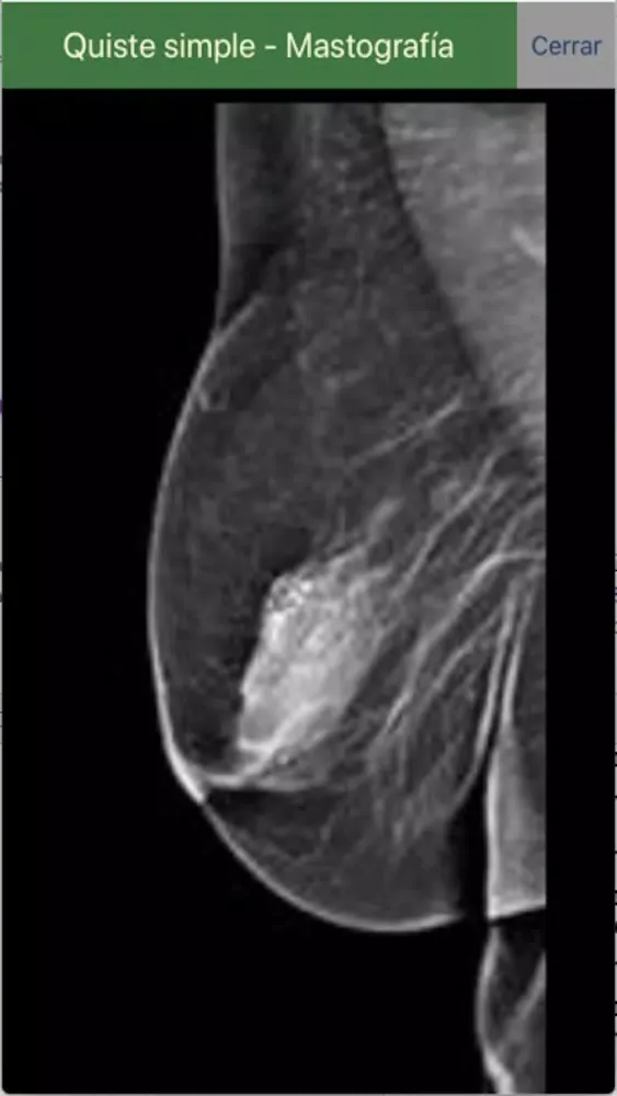 Telerradiología -Educativa Screenshots