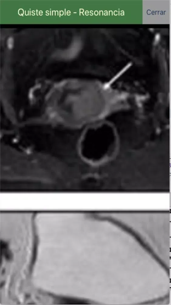 Telerradiología -Educativa Screenshots