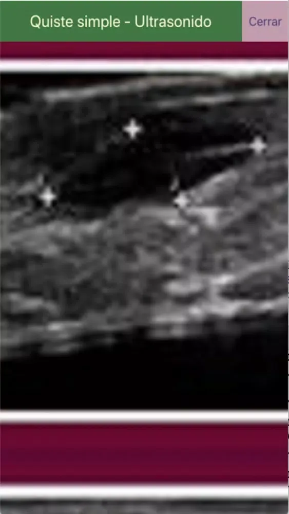 Telerradiología -Educativa Screenshots