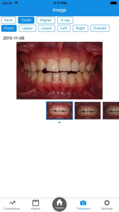 OrthoComm Aligner Management سکرین شاٹس