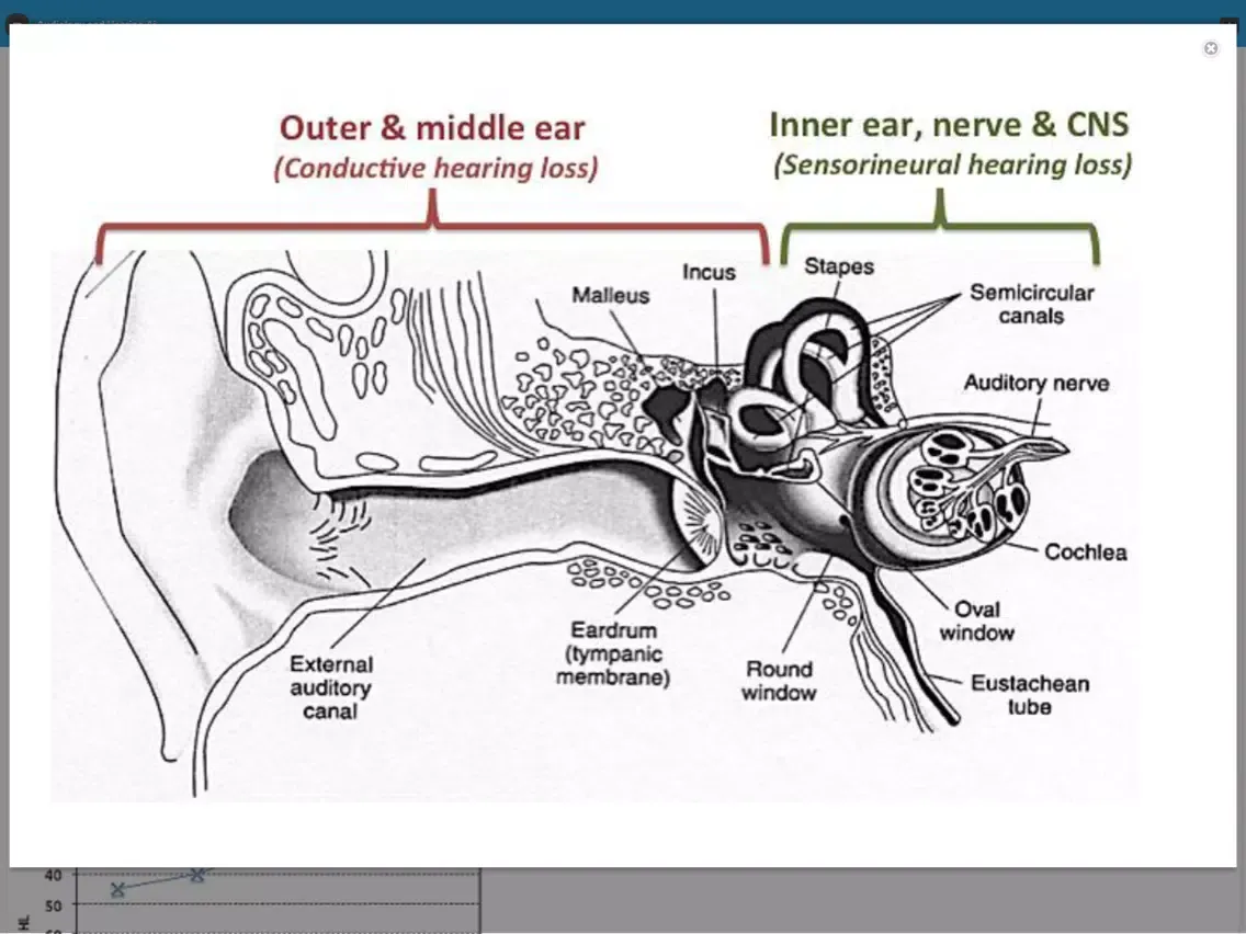 Screenshot di Audiology and Hearing Aids for Otolaryngologist iPad 