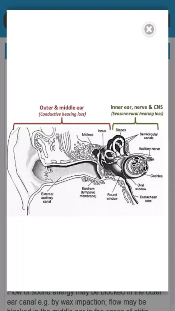 Screenshot di Audiology and Hearing Aids for Otolaryngologist