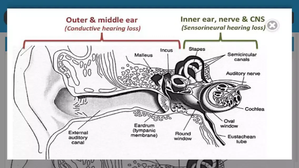 Screenshot di Audiology and Hearing Aids for Otolaryngologist