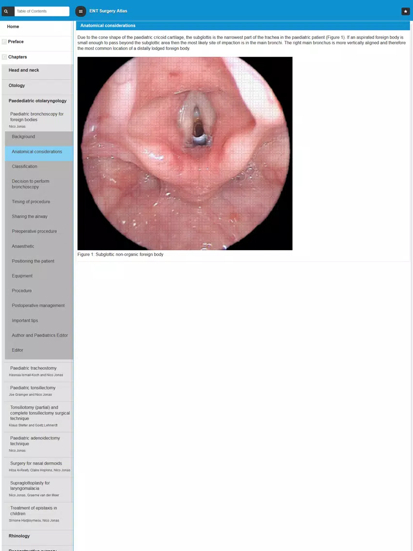 Capturas de tela do ENT Surgery Atlas iPad 
