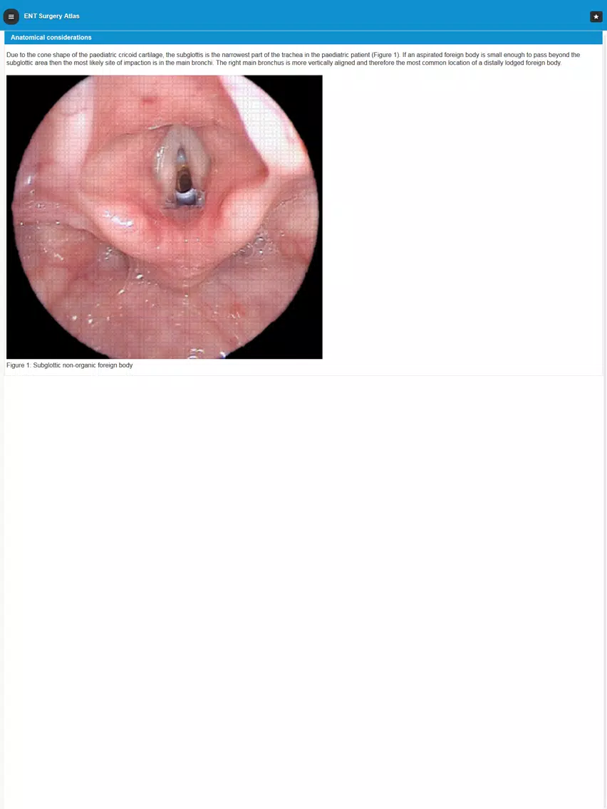 Capturas de tela do ENT Surgery Atlas iPad 