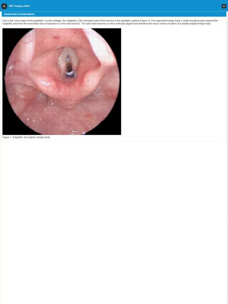Screenshot di ENT Surgery Atlas iPad 