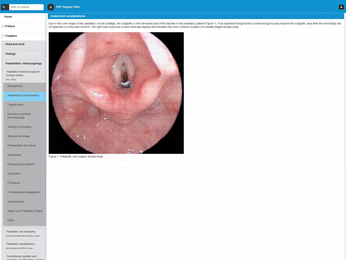 Capturas de tela do ENT Surgery Atlas iPad 
