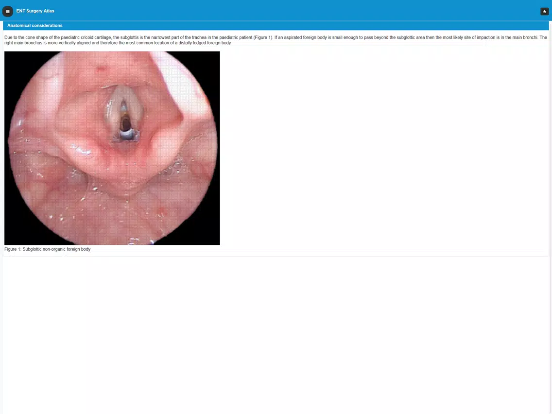 Capturas de tela do ENT Surgery Atlas iPad 
