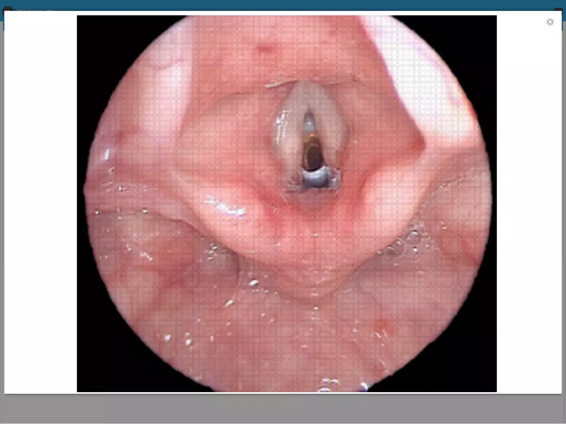 Capturas de tela do ENT Surgery Atlas iPad 