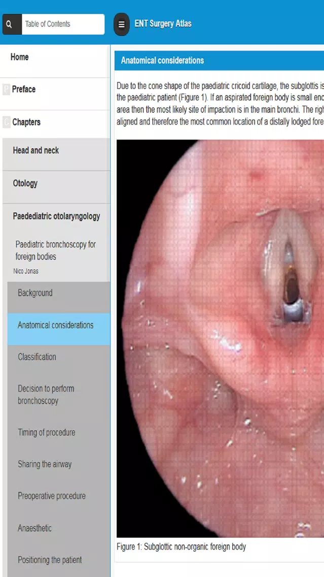 Capturas de tela do ENT Surgery Atlas