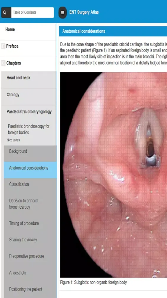 Screenshot di ENT Surgery Atlas