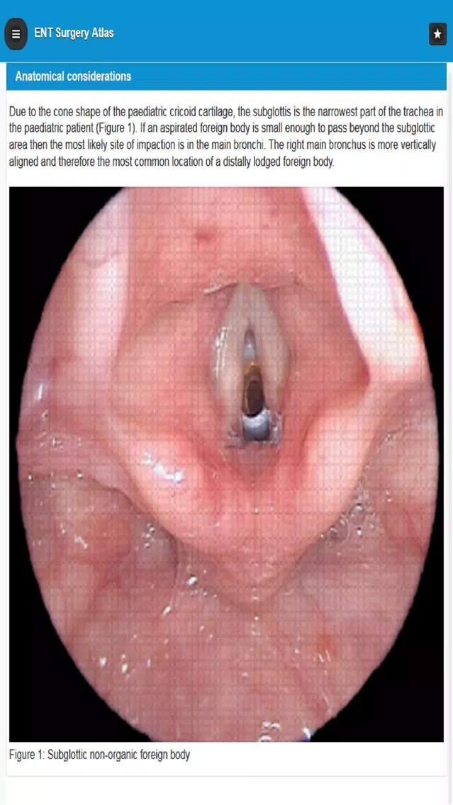 Capturas de tela do ENT Surgery Atlas
