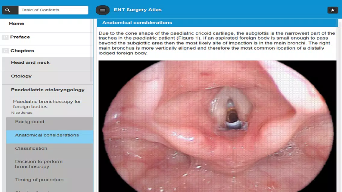 Capturas de tela do ENT Surgery Atlas