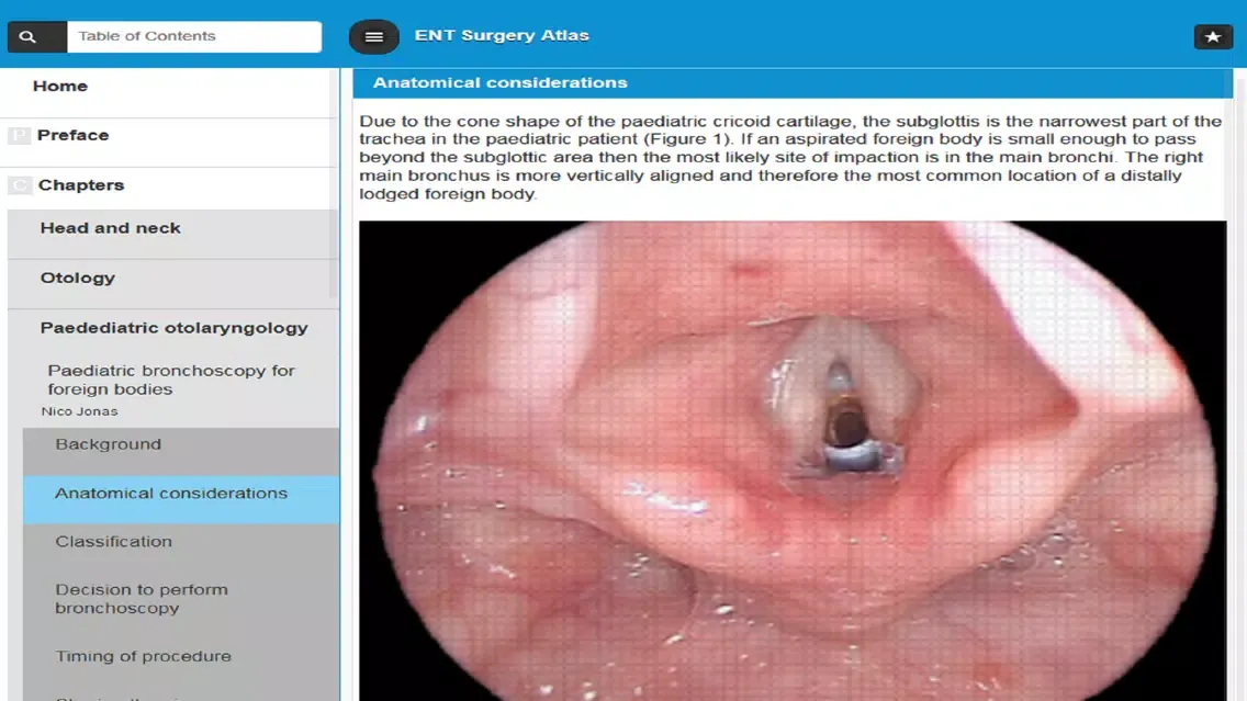 Screenshot di ENT Surgery Atlas