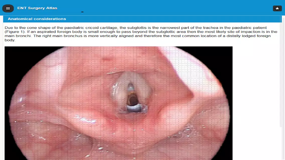 Capturas de tela do ENT Surgery Atlas