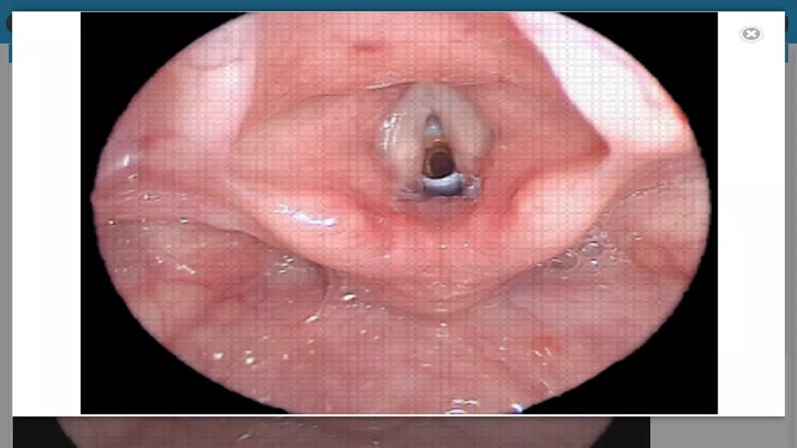 Capturas de tela do ENT Surgery Atlas