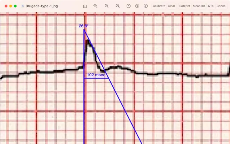 Tangkapan layar EP Calipers