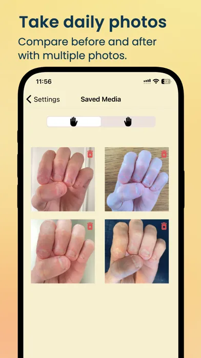 Tangkapan layar NailKeeper - Stop Biting Nails
