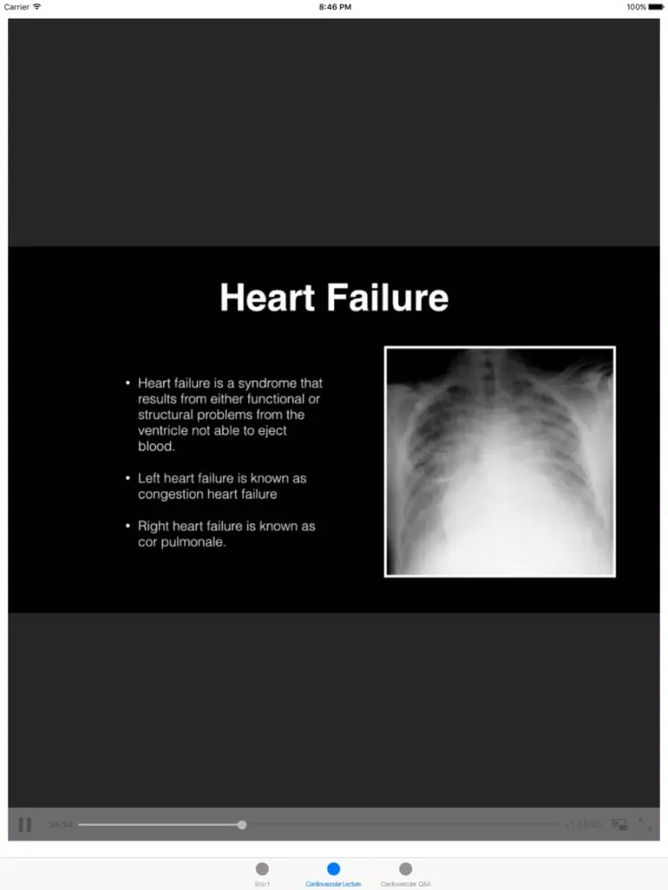 Capturas de tela do Cardiovascular Blueprint PANCE PANRE Review Couse iPad 