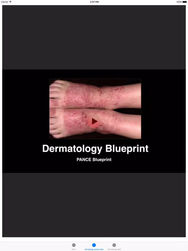 Tangkapan layar Dermatology Blueprint PANCE Review Course iPad 