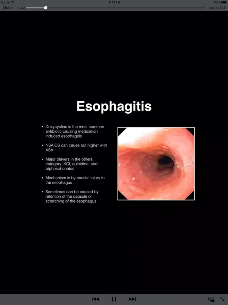 تصاویر Gastrointestinal Blueprint PANCE PANRE Review Course iPad 