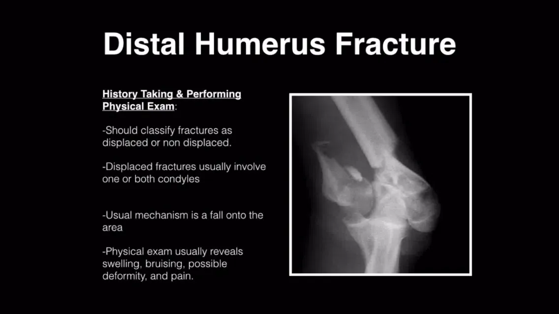 تصاویر Musculoskeletal Blueprint PANCE PANRE Review Course