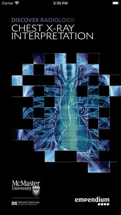 ภาพหน้าจอของ Chest X-ray Interpretation