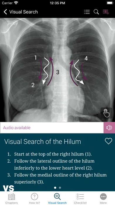 ภาพหน้าจอของ Chest X-ray Interpretation