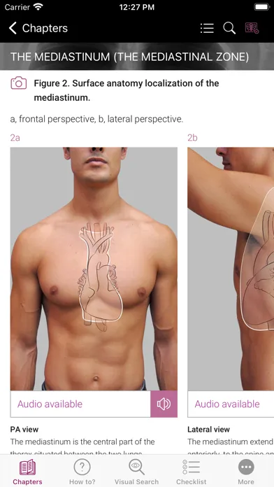 ภาพหน้าจอของ Chest X-ray Interpretation