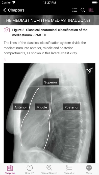 ภาพหน้าจอของ Chest X-ray Interpretation
