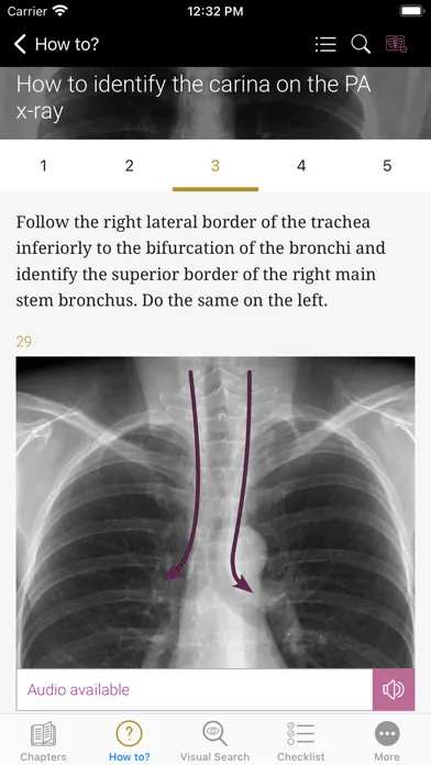 ภาพหน้าจอของ Chest X-ray Interpretation