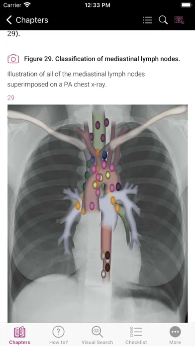 ภาพหน้าจอของ Chest X-ray Interpretation