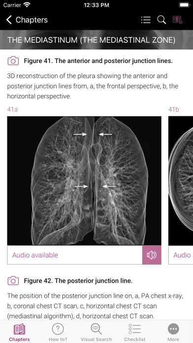 ภาพหน้าจอของ Chest X-ray Interpretation