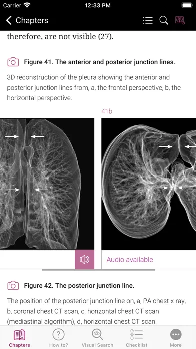 ภาพหน้าจอของ Chest X-ray Interpretation
