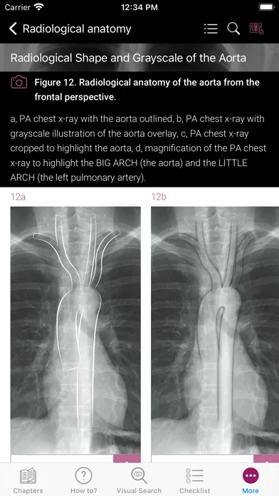ภาพหน้าจอของ Chest X-ray Interpretation