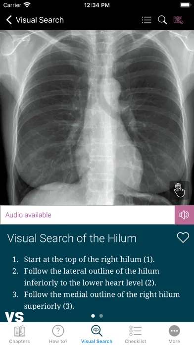 ภาพหน้าจอของ Chest X-ray Interpretation