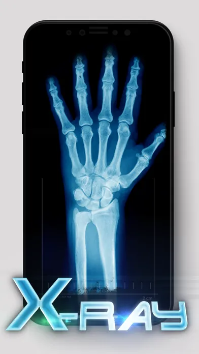 Best X-Ray Screenshots