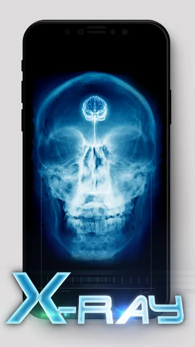 Best X-Ray Screenshots