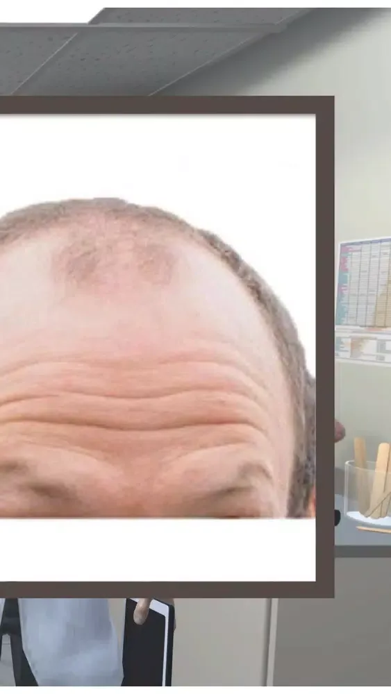 STOP Hair Loss App Screenshots