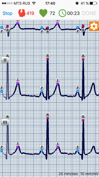 ECG Dongle Screenshots