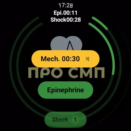 CPR assistant. ProSMP Screenshots