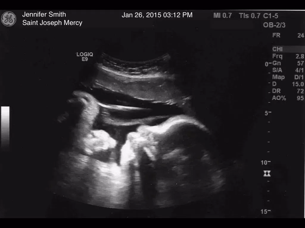 Zrzuty ekranu Ultrasound Spoof Free + iPad 
