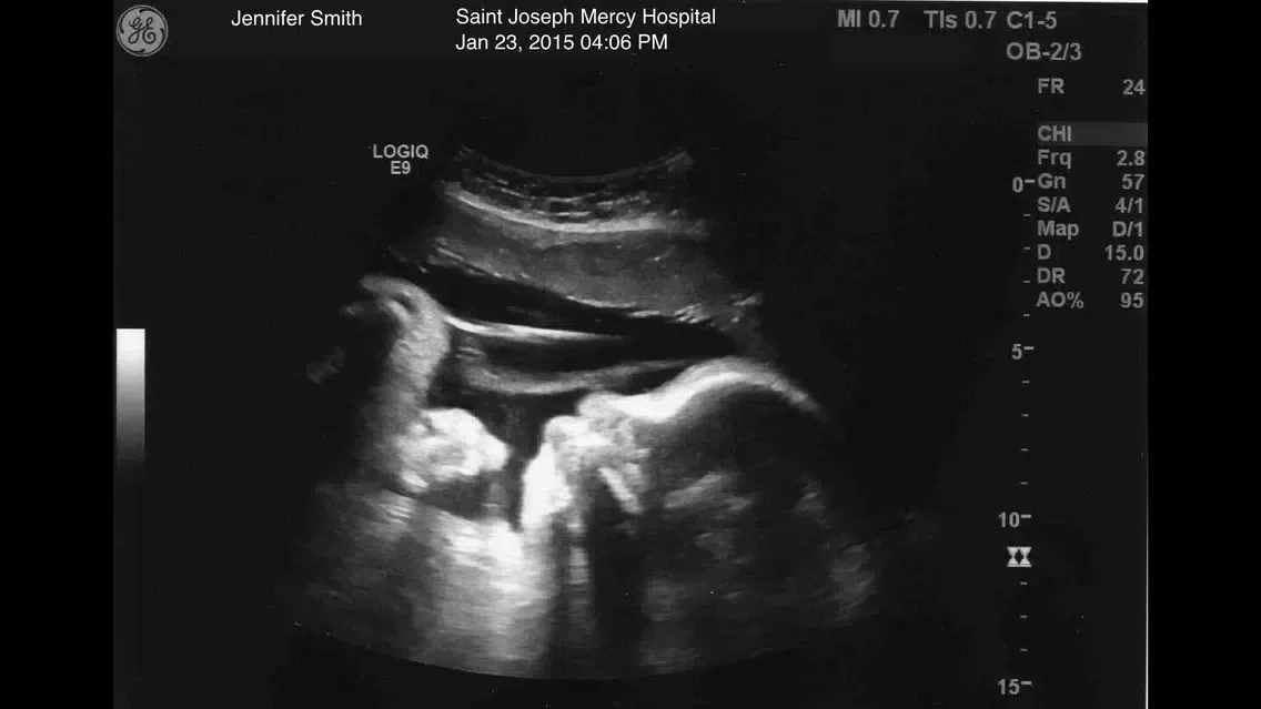 Zrzuty ekranu Ultrasound Spoof Free +