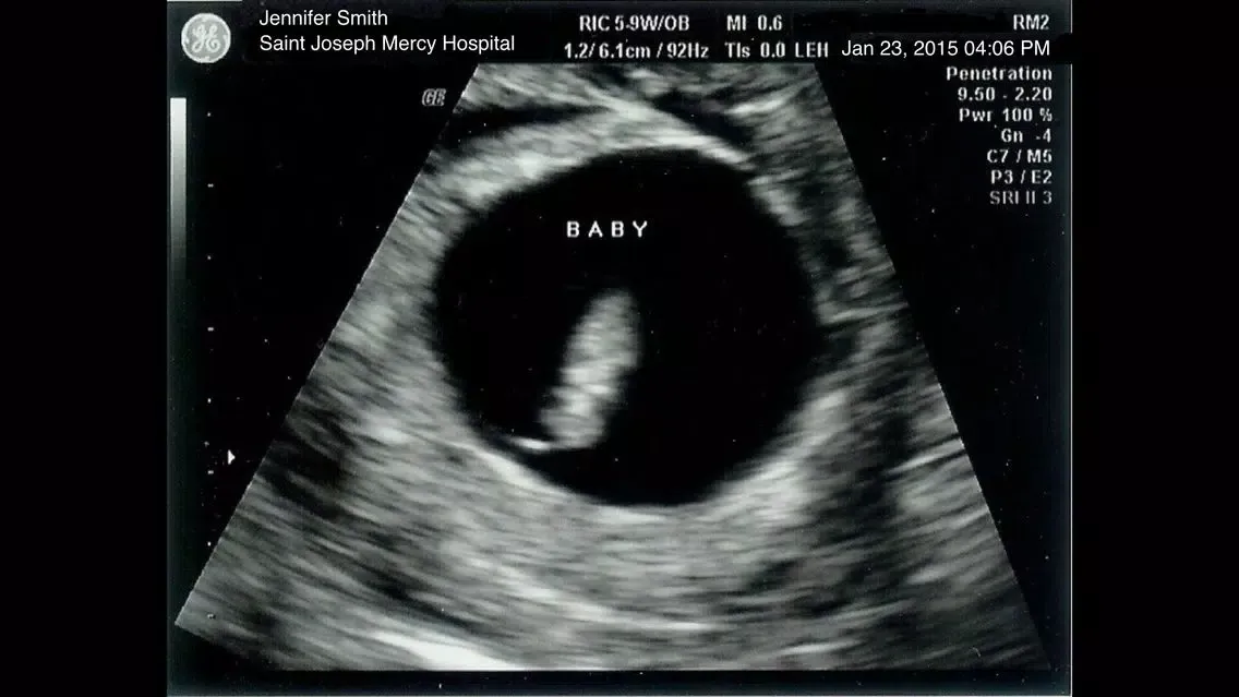 Zrzuty ekranu Ultrasound Spoof Free +