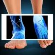 Xray Fracture Foot Prank Xray Fracture Foot Prank