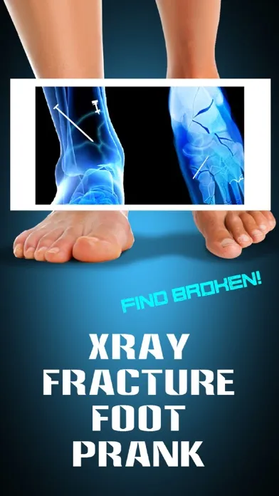 صور Xray Fracture Foot Prank