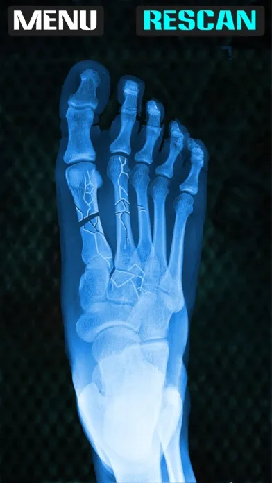 صور Xray Fracture Foot Prank