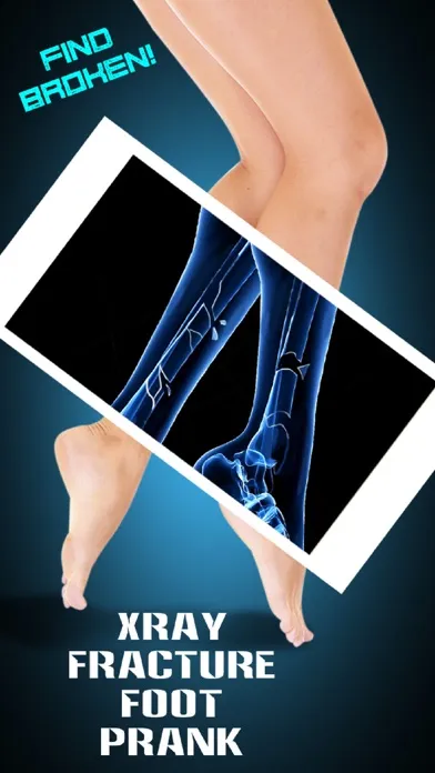 صور Xray Fracture Foot Prank